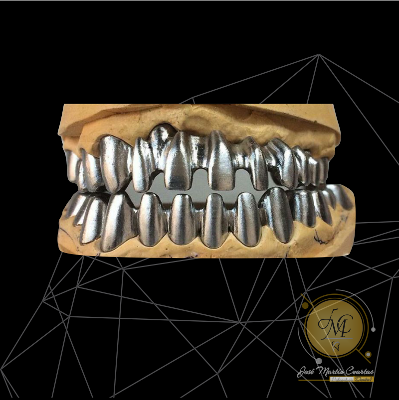 Metal-Ceramic 3 Dental Laboratory Martin Cuartas